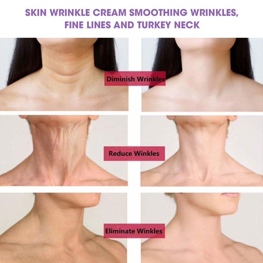 Kem Collagen Làm Trắng Da Mặt Chống Nếp Nhăn Và Làm Săn Chắc Da