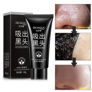 Kem lột mụn đầu đen