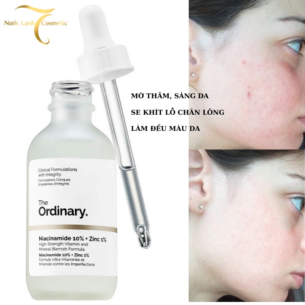 [Bill Canada] The Ordinary Niacinamide 10% + Zin 1% Tinh Chất Se Khít Lỗ Chân Lông, Mờ Thâm