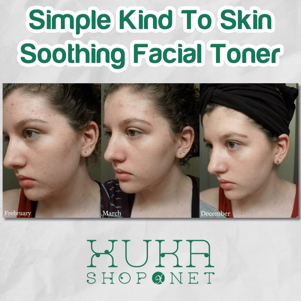 Nước hoa hồng Simple Toner cân bằng dịu nhẹ Simple Soothing Facial Toner cân bằng ẩm cho da nhạy cảm 200ml