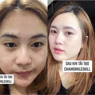 Kem tái tạo chamomileskill Mẫu Mới