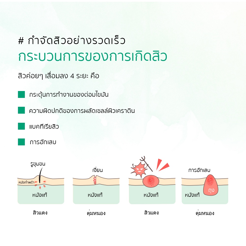 Toner Breylee với tinh chất cây trà cải thiện mụn nhọt hiệu quả cao 100ml