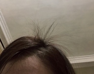 Combo kích mọc tóc