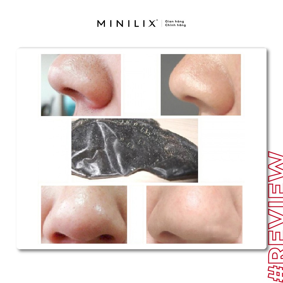 Miếng dán mũi lột mụn Biore hộp 4 miếng - cải thiện mụn đầu đen/mụn cám phần cánh mũi - [MINILIX] | BigBuy360 - bigbuy360.vn