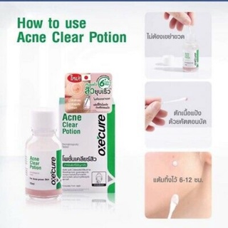 Tinh chất chấm mụn Oxecure