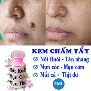 Tẩy mụn cóc nốt ruồi tàn nhang mắc cá ,mụn thịt