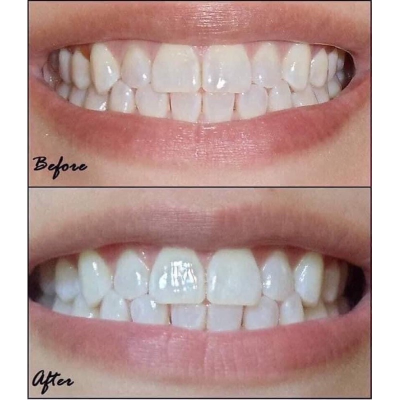 Kem đánh răng cao cấp CREST 3D WHITE