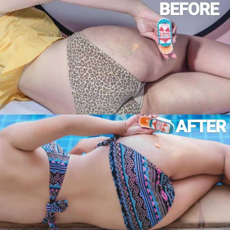 [Hàng mới về] Sáp loại bỏ sắc tố melanin hiệu quả