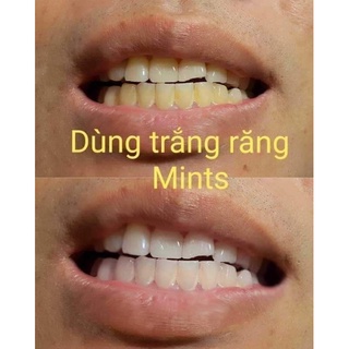Bột trắng răng Mints