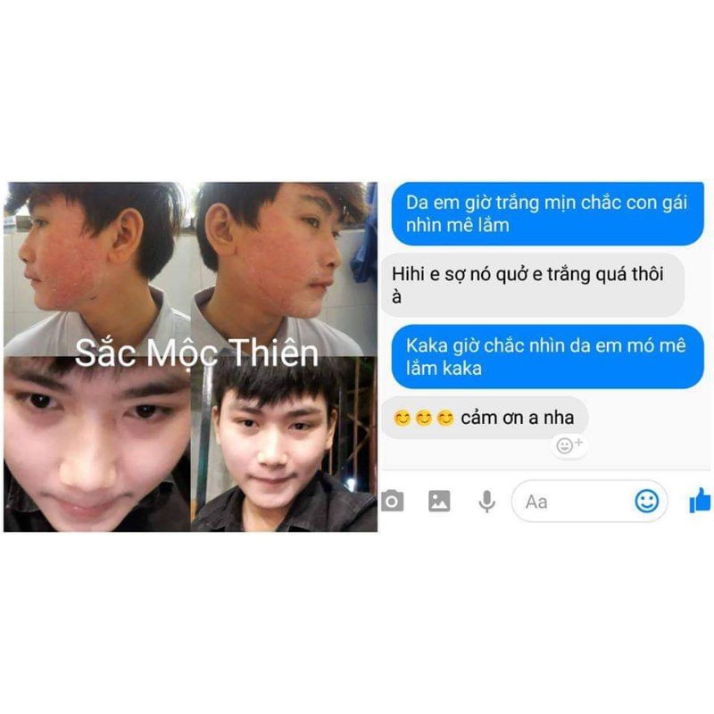 Tái tạo da cao cấp Sắc Mộc Thiên- Hỗ trợ cải thiện mụn- Nám- Tàn nhang- Sẹo | BigBuy360 - bigbuy360.vn