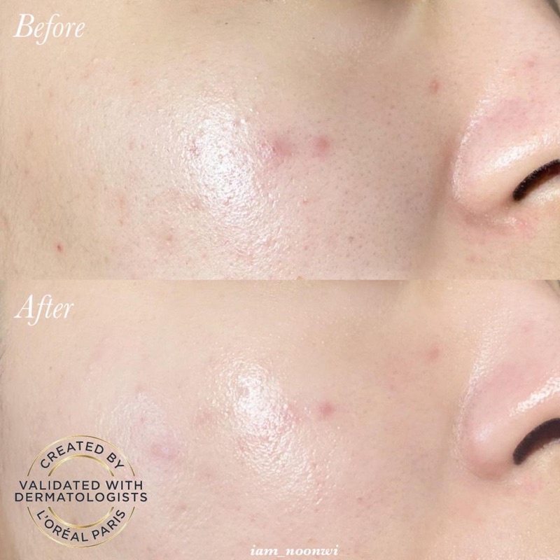 Serum dưỡng sáng mờ thâm nám L'Oreal Paris Glycolic Bright 1.0% Glycolic Acid