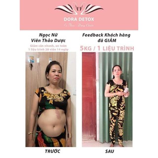 DORA DETOX VIP + KHÔNG TẶNG CAO