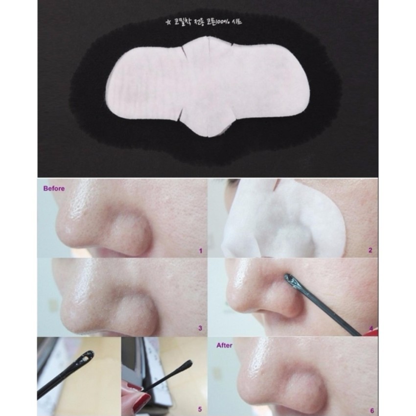 Lột mụn đầu đen Ciracle Black Head Off Cotton Mask