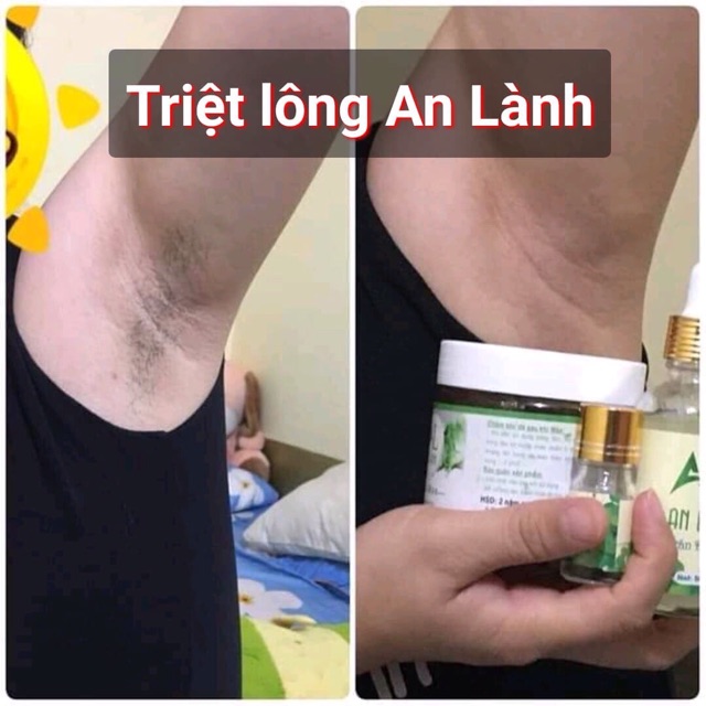 Combo triệt lông an lành | BigBuy360 - bigbuy360.vn