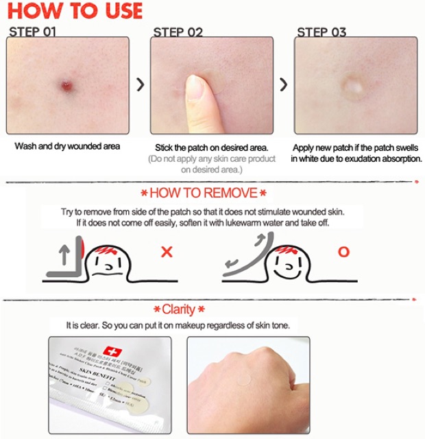 Miếng dán cho mụn Acne Pimple Master Patch