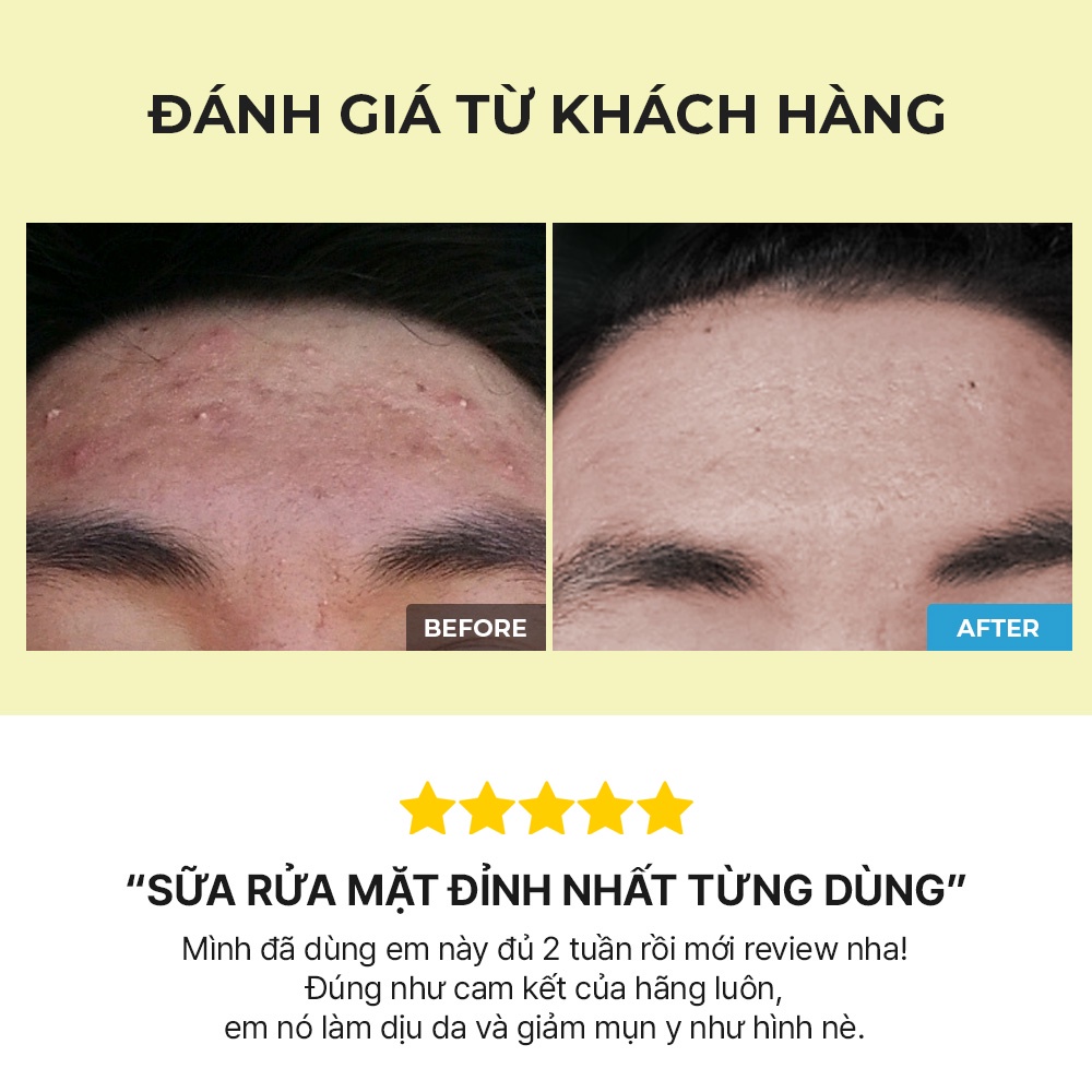 (Quà tặng kèm) Gel rửa mặt COSRX Low pH Good Morning Gel Cleanser 20ml chiết xuất trà xanh độ ph thấp