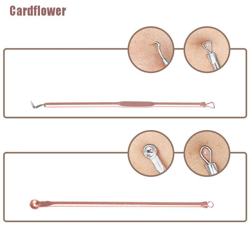 [Hàng mới về] Set 4 dụng cụ nặn mụn bằng thép không gỉ chất lượng cao tiện dụng