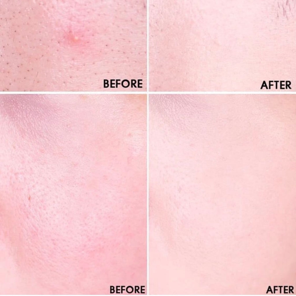 MBC Che khuyết điểm EH Big Cover | BigBuy360 - bigbuy360.vn