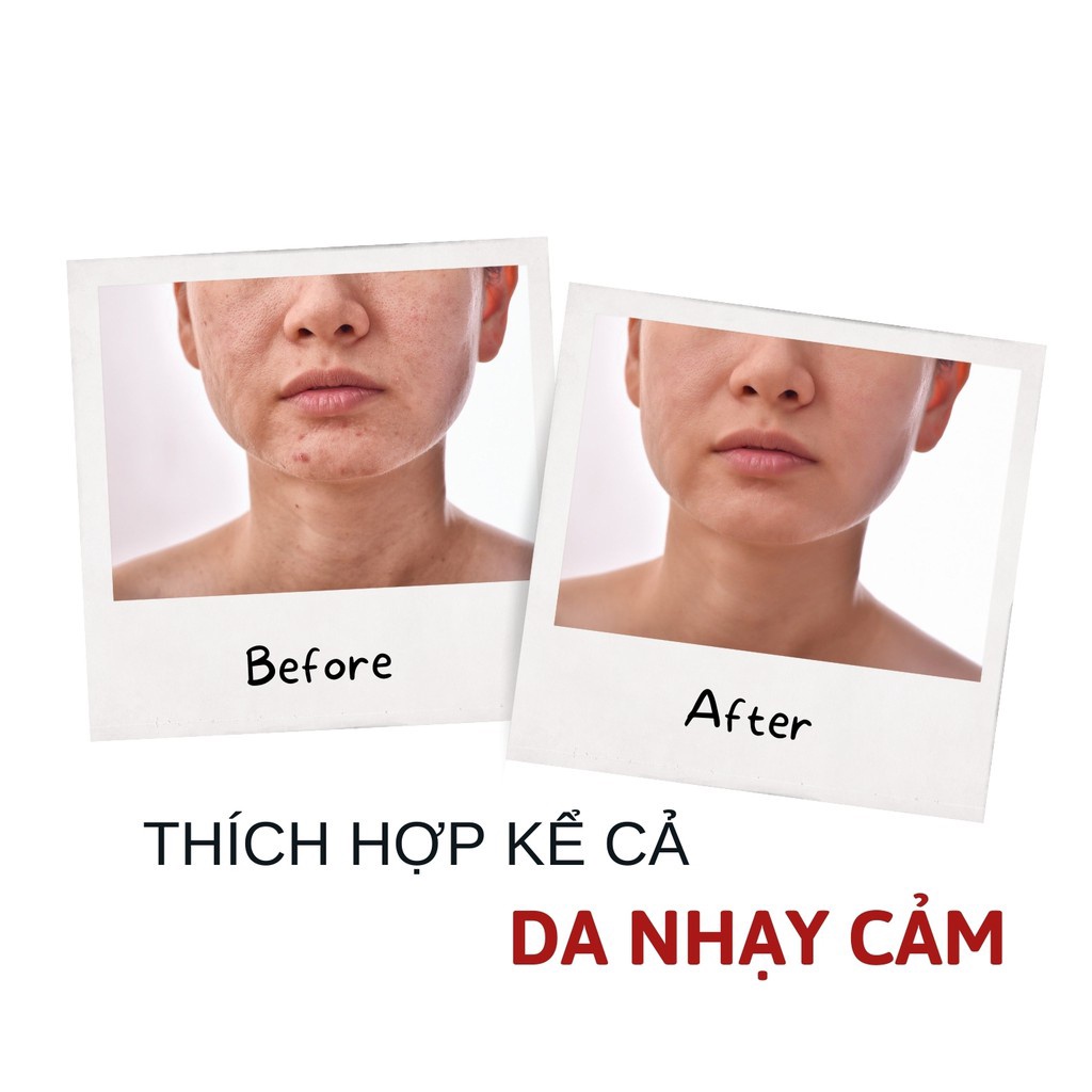 Mặt nạ nhau thai tế bào gốc Rwine Beauty-  giúp phục hồi, dưỡng trắng từ sâu bên trong