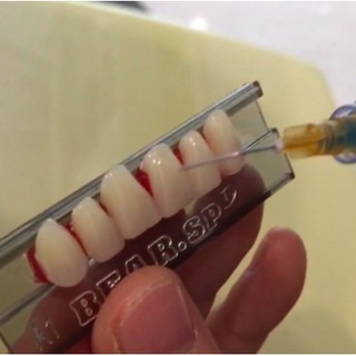 Răng giả, răng mẫu tập đính đá và đắp khểnh lên răng