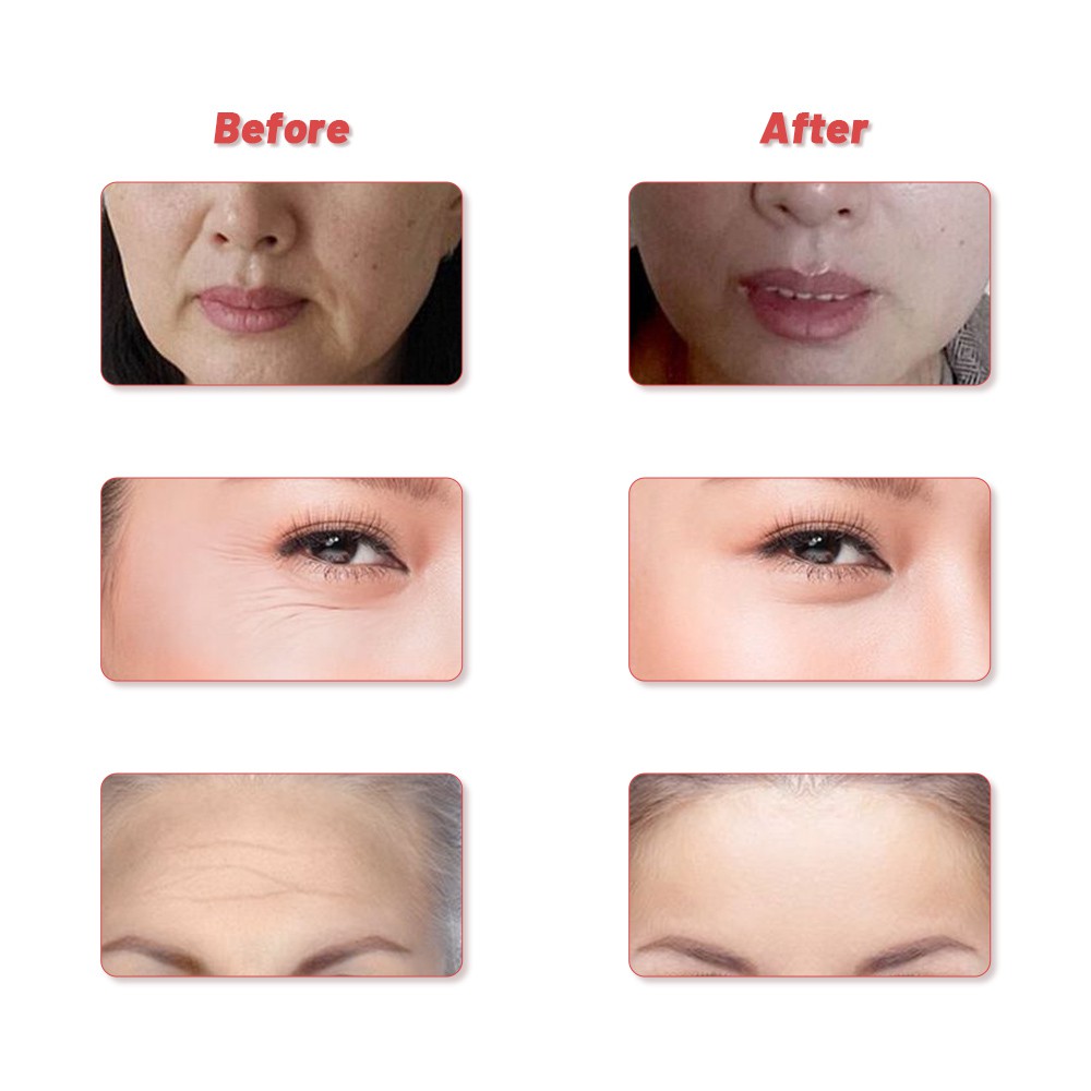 Máy massage mặt cầm tay đa vị trí toàn thân nâng cơ mặt chống nếp nhăn