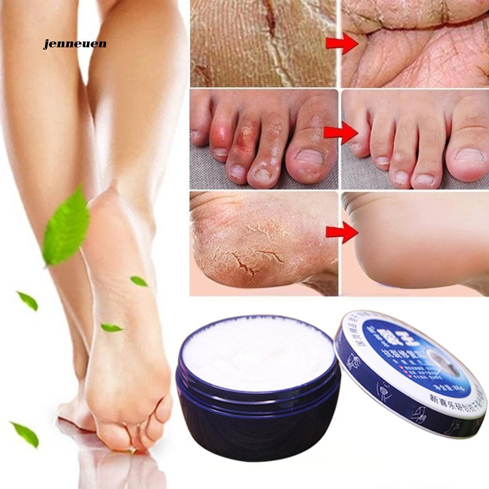 Kem dưỡng ẩm chống nứt nẻ da chân hiệu quả an toàn