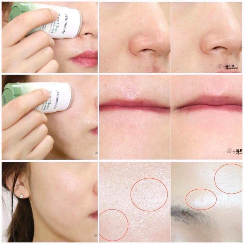 THANH LĂN HÚT MỤN MAMONDE PORE CLEAN BLACK HEAD STICK