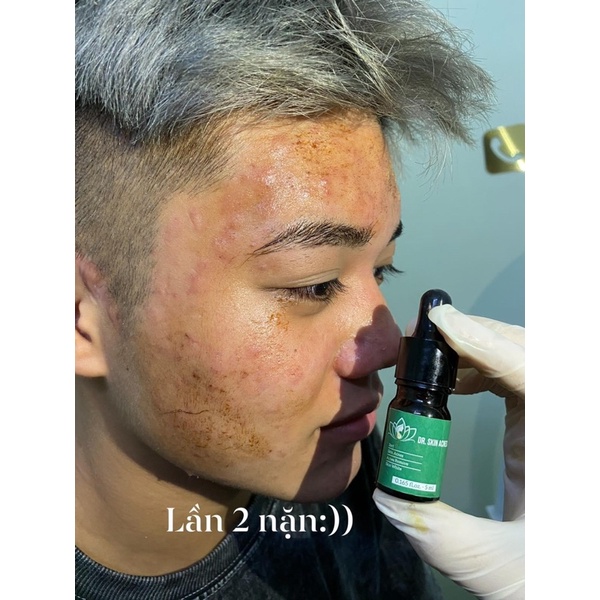Combo 2lọ serum mụn ( drskinacnes)