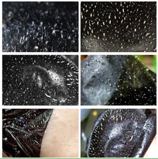 Lột mụn Black head