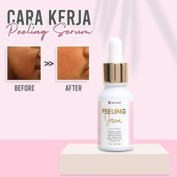 (hàng Mới Về) Serum 4.4 Ms Phát Sáng / Vàng / Trắng / Trị Mụn / Nâng Cơ Mặt