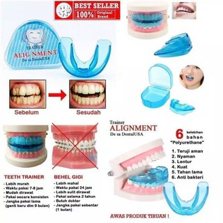 Dụng Cụ Hỗ Trợ Chỉnh Hình Răng Chuyên Dụng