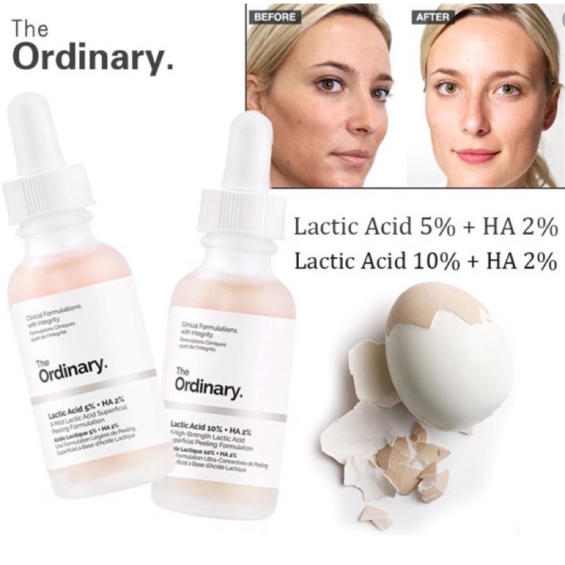 [Bill Sephora US] Serum tẩy tế bào chết The Ordinary Lactic Acid 10% + HA | BigBuy360 - bigbuy360.vn