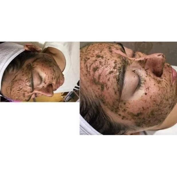 1 Hộp Btox Peel 2 màu thay da sinh học cam kết hàng chính hãng