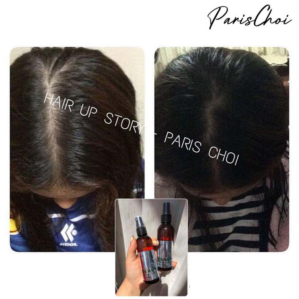 TINH CHẤT MỌC TÓC HAIR UP STORY PARIS CHOI GENIE NHẬP KHẨU CHÍNH HÃNG