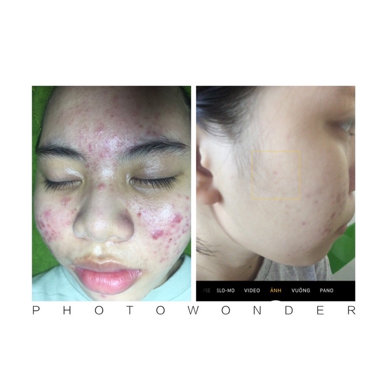 Bộ kem tái tạo da 210