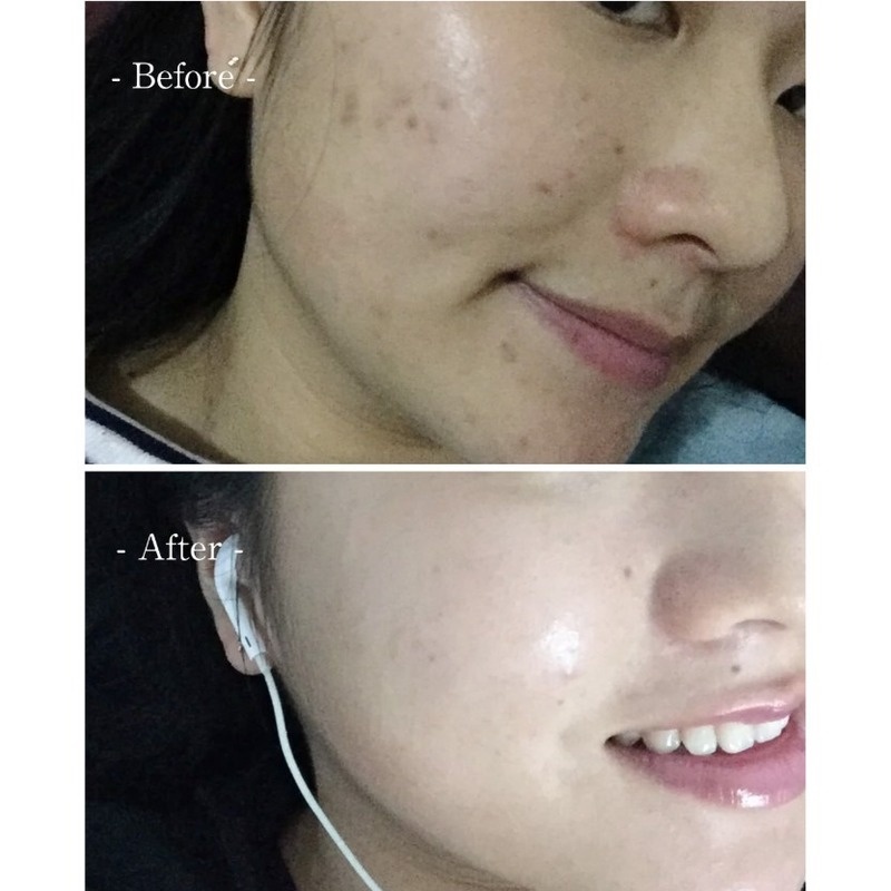 Kem Dưỡng Da Rohto Melano CC Từ Nhật Bản Rohto Melano CC Vitamin C Dưỡng Ẩm Và Làm Trắng Da 20g