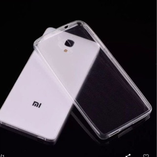 Ốp lưng dẻo cao cấp trong suốt cho Xiaomi Mi4X