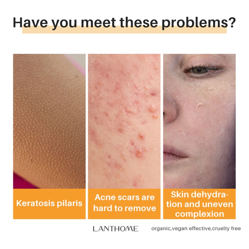 Xà Phòng Tắm Axit Kojic Làm Sáng Và Đều Tông Màu Da Cho Nam Và Nữ