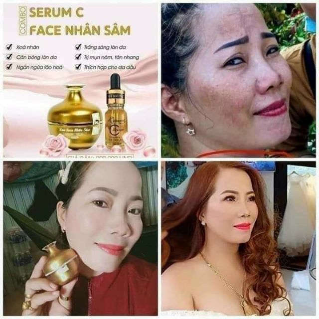 BỘ FACE SÂM + SERUM C (TẶNG KÈM SÉT TẨY TẾ BÀO CHẾT)