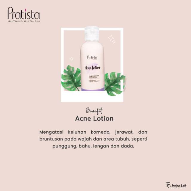 (Hàng Mới Về) Lotion Trị Mụn Đầu Đen Hiệu Quả Hiệu Quả