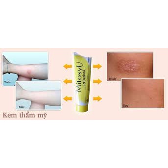 Kem dưỡng phục hồi giảm sẹo thâm Mitosyl change 145g