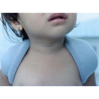 ❤Đai số 8 orbe đai xương đòn cố định xương đòn, xương bả vai trẻ em Orbe đai xương đòn số 8 size nhỏ cho bé Orbe