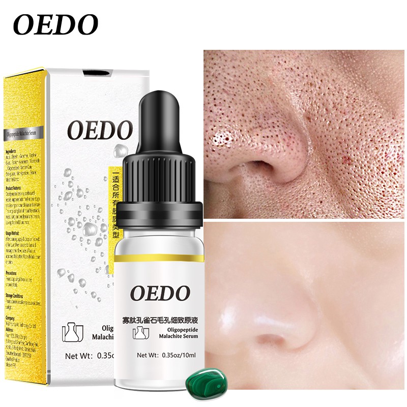 Serum OEDO Oligopeptide Malachite giảm vết nhăn chống lão hóa làm trắng da se khít lỗ chân lông dạng lỏng da mặt