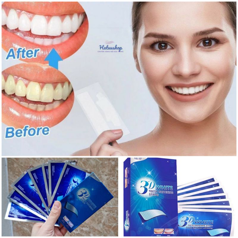 Miếng dán trắng răng tiện lợi 3D White Teeth Whitening strips