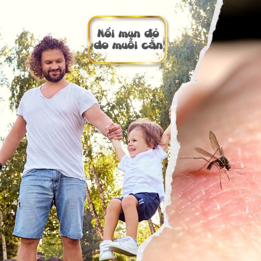 Xịt chống muỗi và côn trùng Vương Tràm Hương, an toàn cho mẹ và bé (combo dạng kem và dạng xịt)