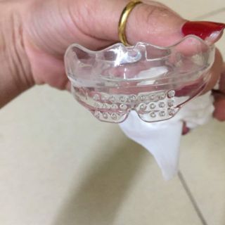 (Lẻ hàm: A1 hoặc A2 hoặc A3) Dụng cụ niềng răng tại nhà