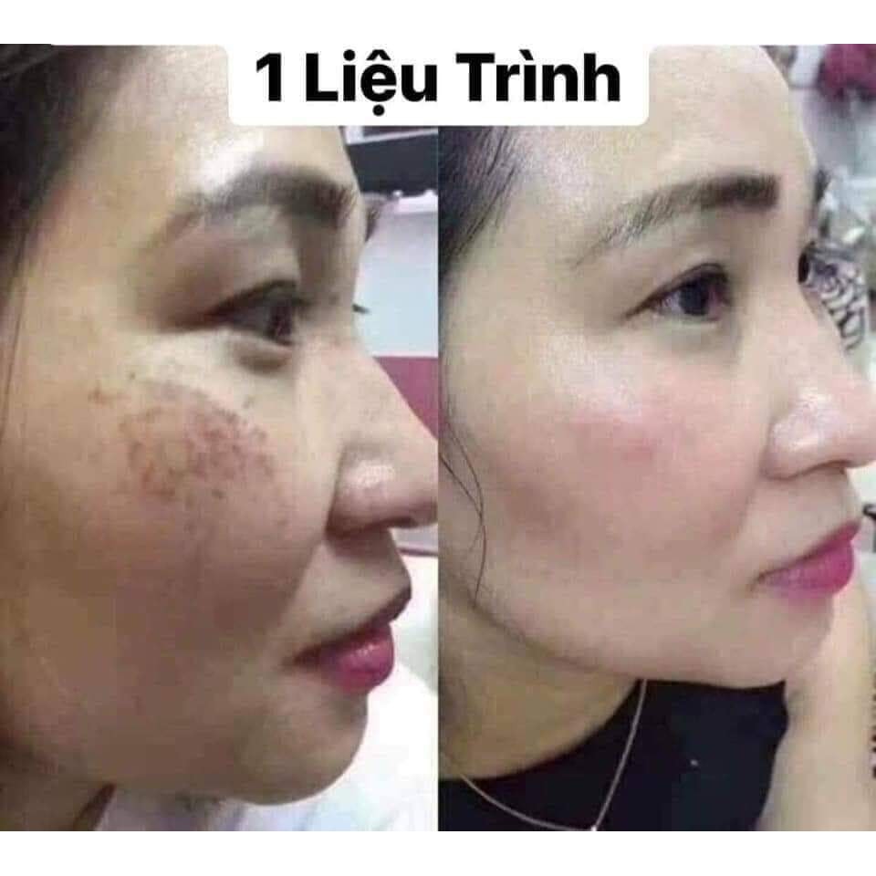 Viên Uống Trắng Da Mờ Nám GLUTATHIONE 600 ĐR LACIR | BigBuy360 - bigbuy360.vn