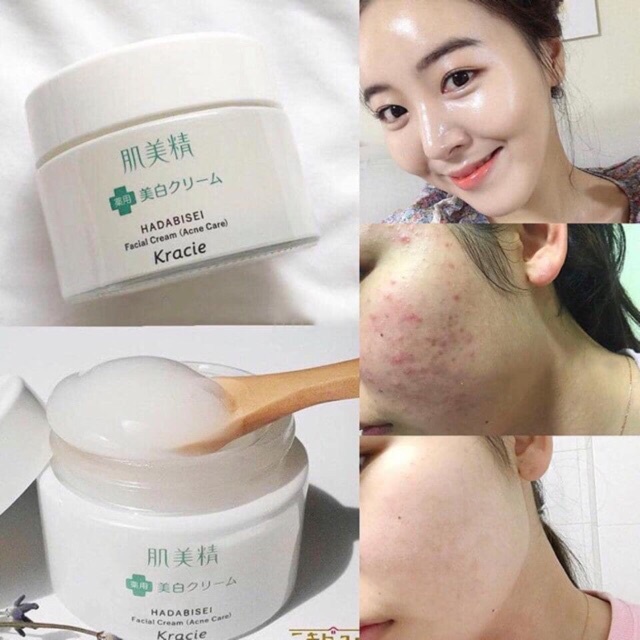 Kem Dưỡng Ngừa Mụn và Sáng Da Kracie Hadabisei Acne 50g - Nhật Bản