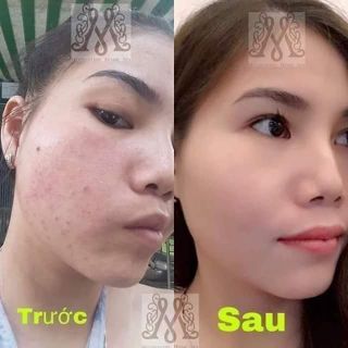 Mặt Nạ Yến Collagen