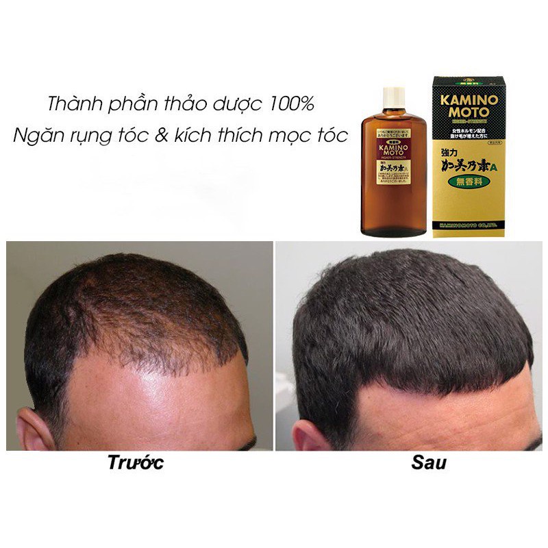 Serum ngăn rụng, kích mọc tóc siêu mạnh Higher Strength Kaminomoto Nhật Bản 200ml